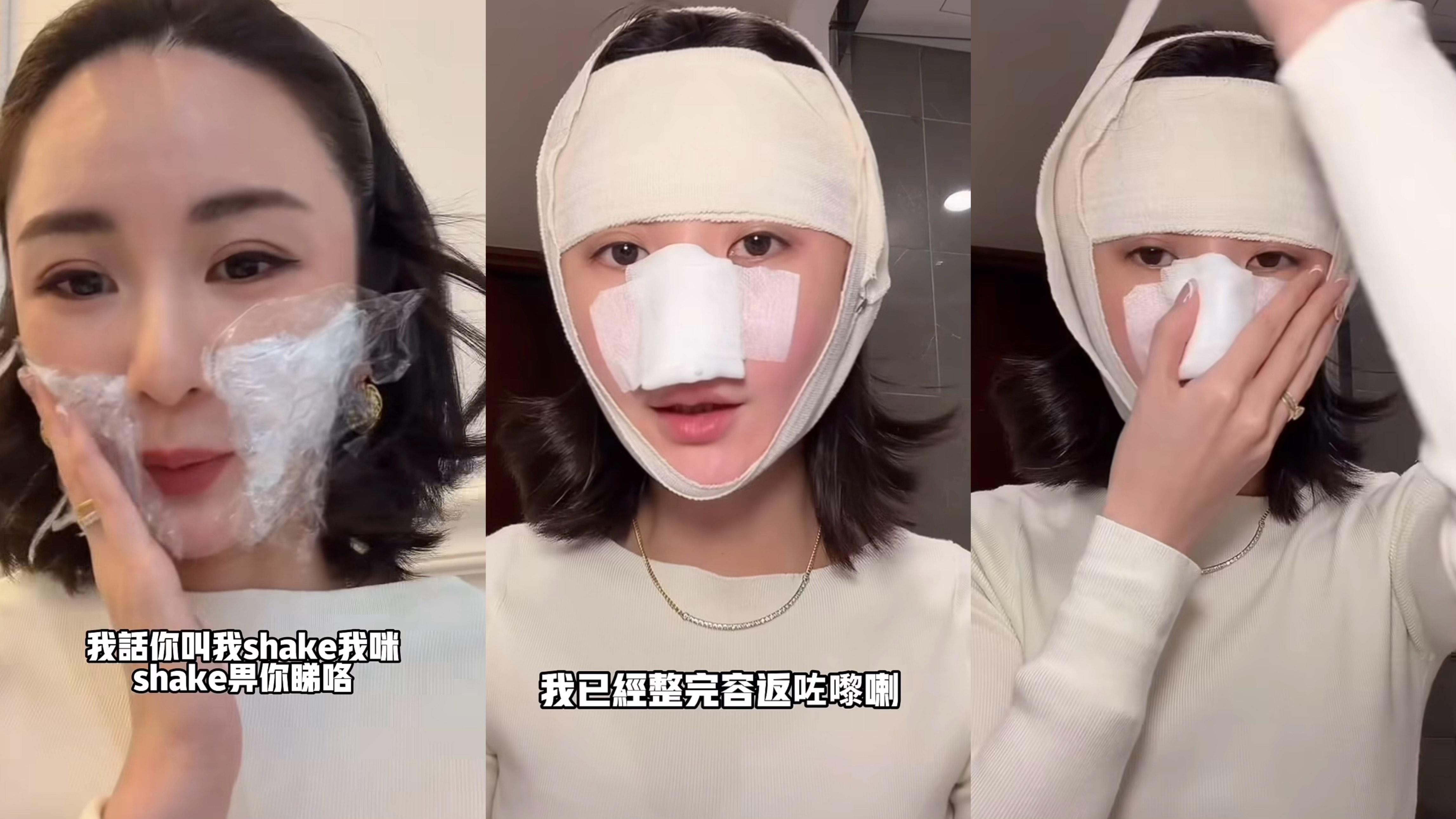 裕美公開首次到韓國整容 鏡頭前拆繃帶直言打鼻梁好痛