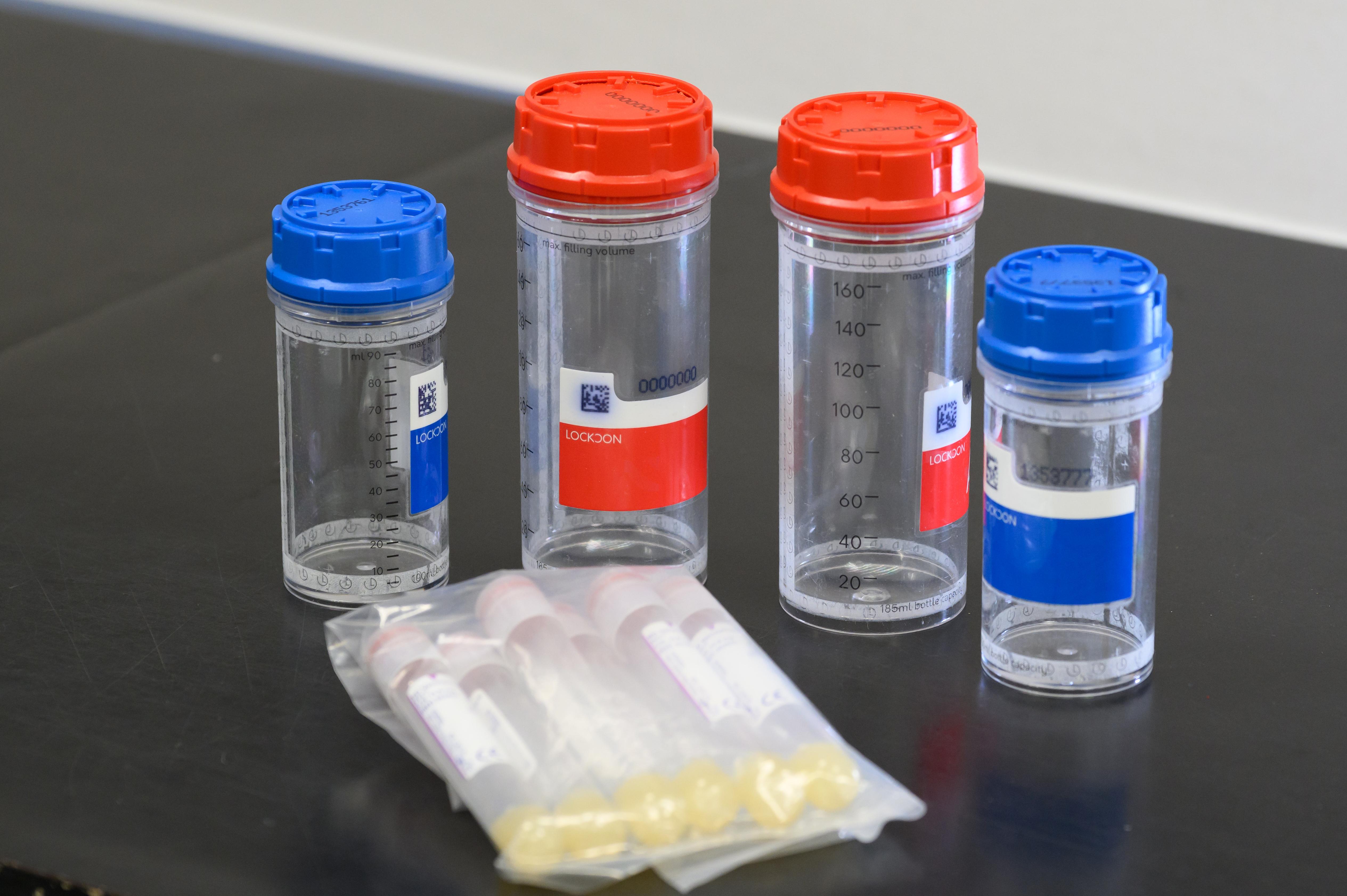 樣本採集器材套裝。(賽馬會提供)