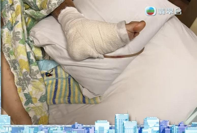 八両金前妻的腳掌嚴重潰爛。