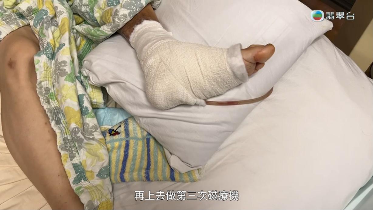 八両菜因為一個水泡搞到細菌受到感染。