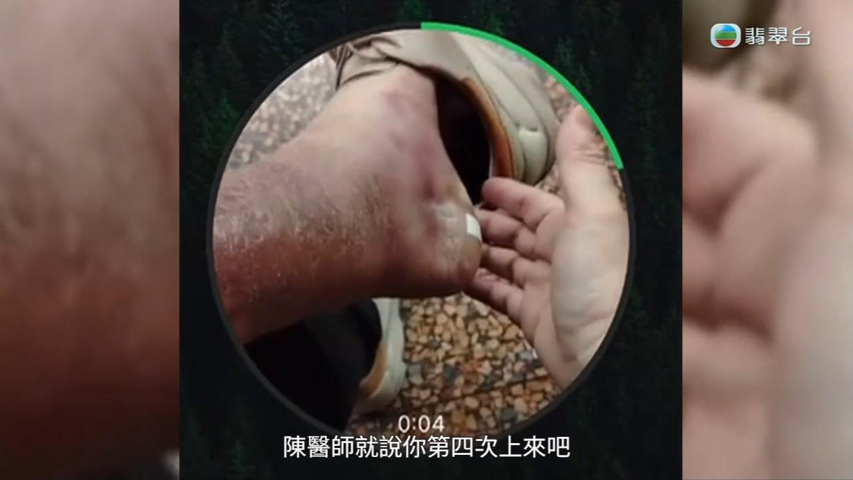 八両菜因為一個水泡搞到細菌受到感染,陳醫師的處理手法令人質疑。