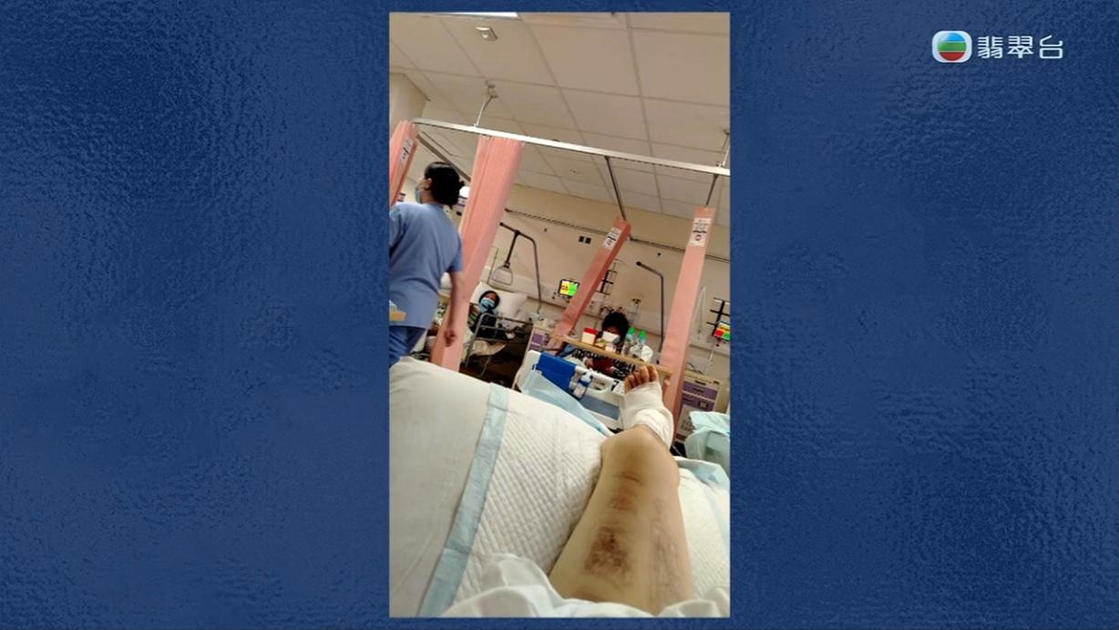 八両菜需要每日清洗傷口,但又因為出血水的問題嚴重,其中一次更令她要接受輸血。