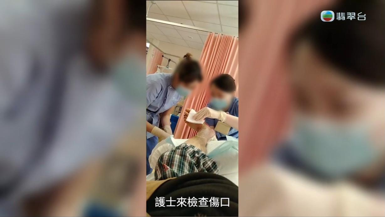 八両菜需要每日清洗傷口,但又因為出血水的問題嚴重,其中一次更令她要接受輸血。