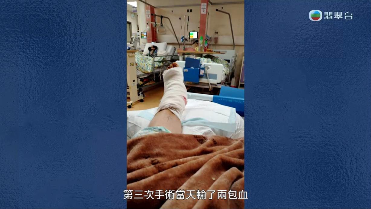 八両菜需要每日清洗傷口,但又因為出血水的問題嚴重,其中一次更令她要接受輸血。