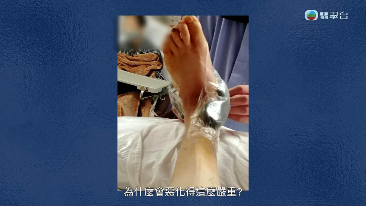 八両菜的左腳康復無期。