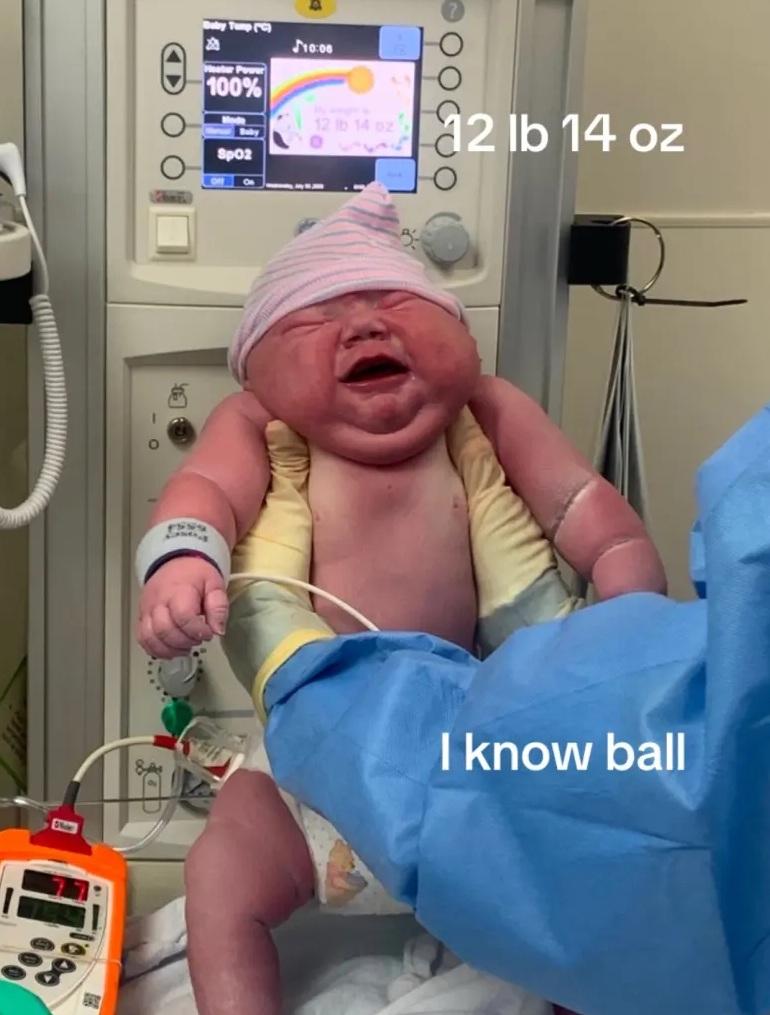 卡西安出生時體重達5.8公斤(12磅14安士),體形十分驚人。(互聯網)