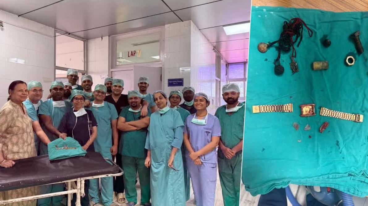 醫療團隊進行長達3小時的緊急微創手術,替男子取出卡食道的手錶和腸道裡的異物。(互聯網)