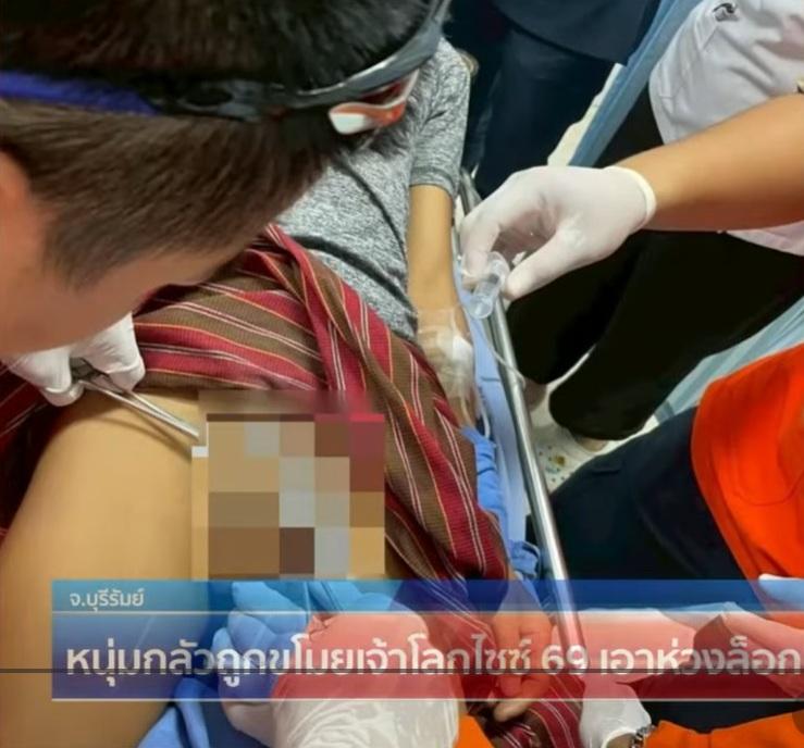 救援隊員小心翼翼用工具,幫男子取走「鎖住」生殖器的環圈。(互聯網)