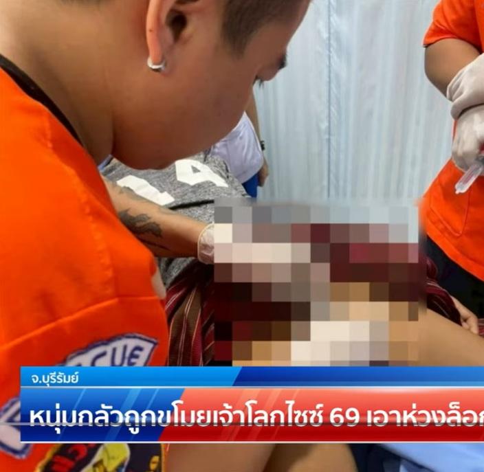 救援隊員小心翼翼用工具,幫男子取走「鎖住」生殖器的環圈。(互聯網)