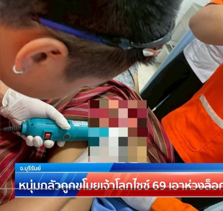 救援隊員小心翼翼用工具,幫男子取走「鎖住」生殖器的環圈。(互聯網)