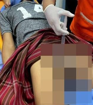 救援隊員想辦法幫男子取走「鎖住」生殖器的環圈。(互聯網)