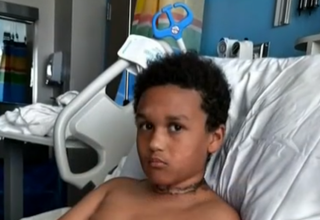 頸鍊纏住平板充電線起火 睡夢中驚醒男童頸燒燶