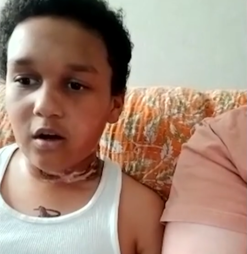 頸鍊纏住平板充電線起火 睡夢中驚醒男童頸燒燶