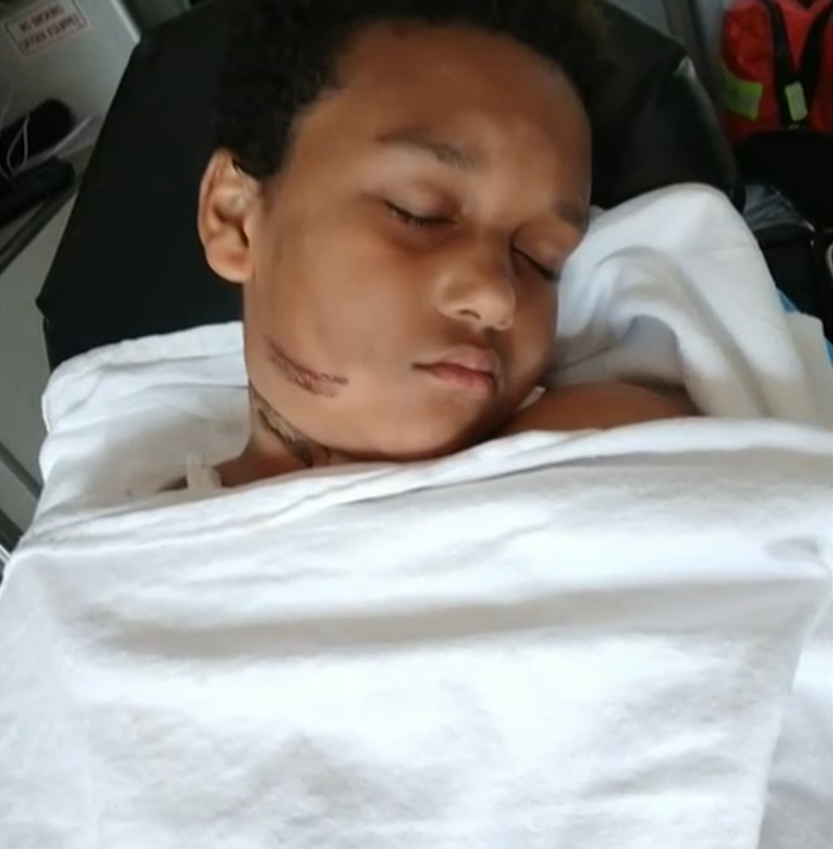 頸鍊纏住平板充電線起火 睡夢中驚醒男童頸燒燶