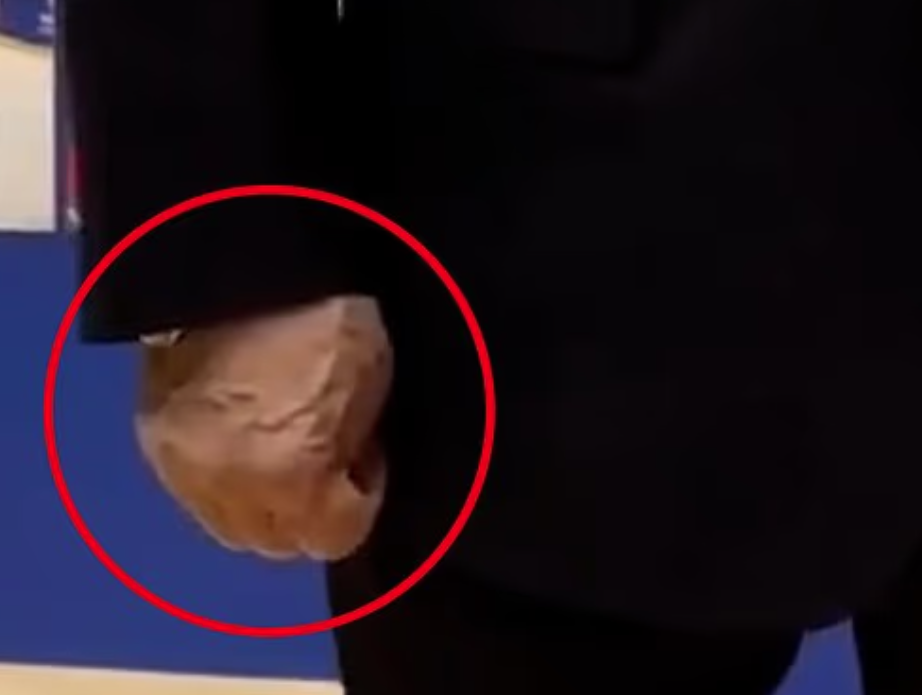 普京被指一直握拳,而且手部青筋暴現。(互聯網)