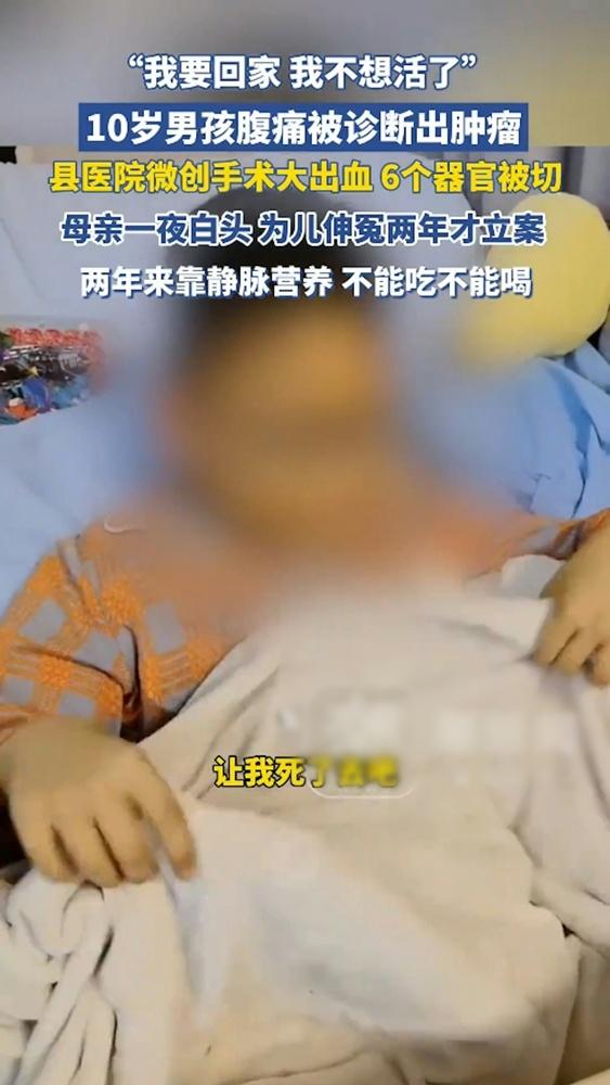 男童的消化系統幾乎沒了,自此無法正常進食或飲水,僅能依靠靜脈注射營養維生。(微博)