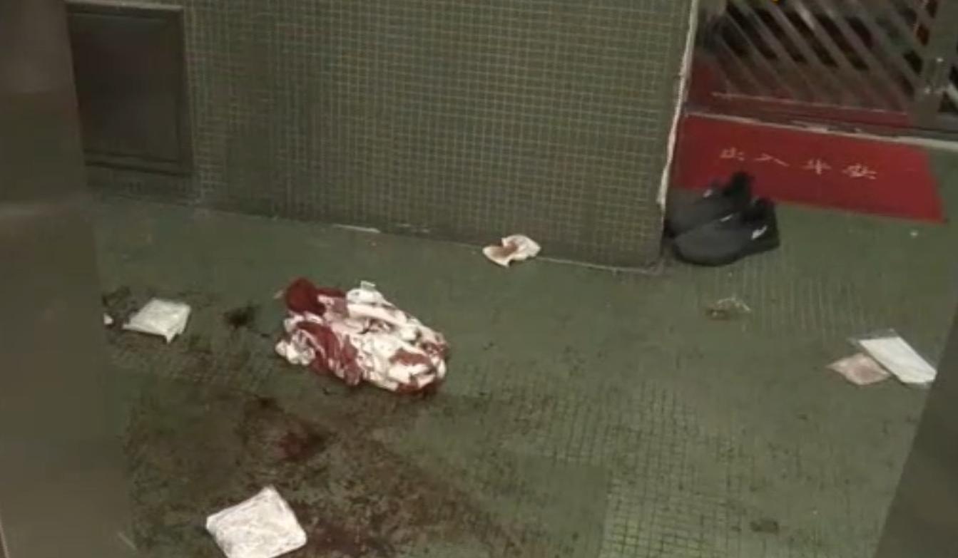 海關人員執行職務時被斬傷。(now新聞截圖)