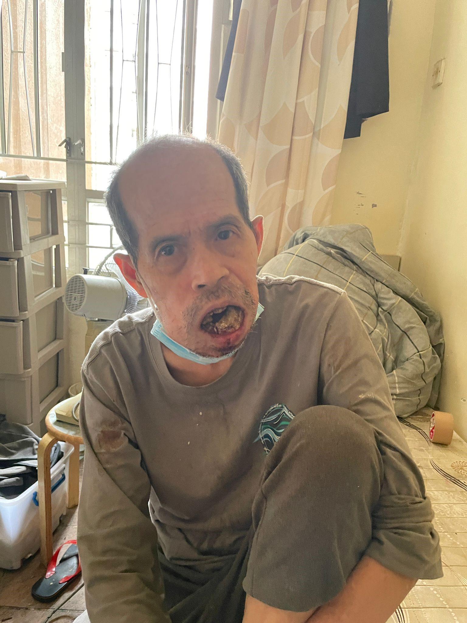 64歲男子鄧仕鑾離開荃灣院舍後失蹤,院舍職員報警。(政府新聞處)