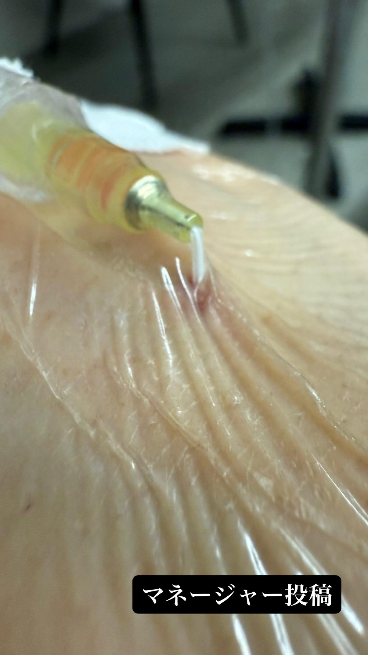 希良梨在2024年9月再度確診罹癌,近日更新限時動態可見在醫院中渡過。