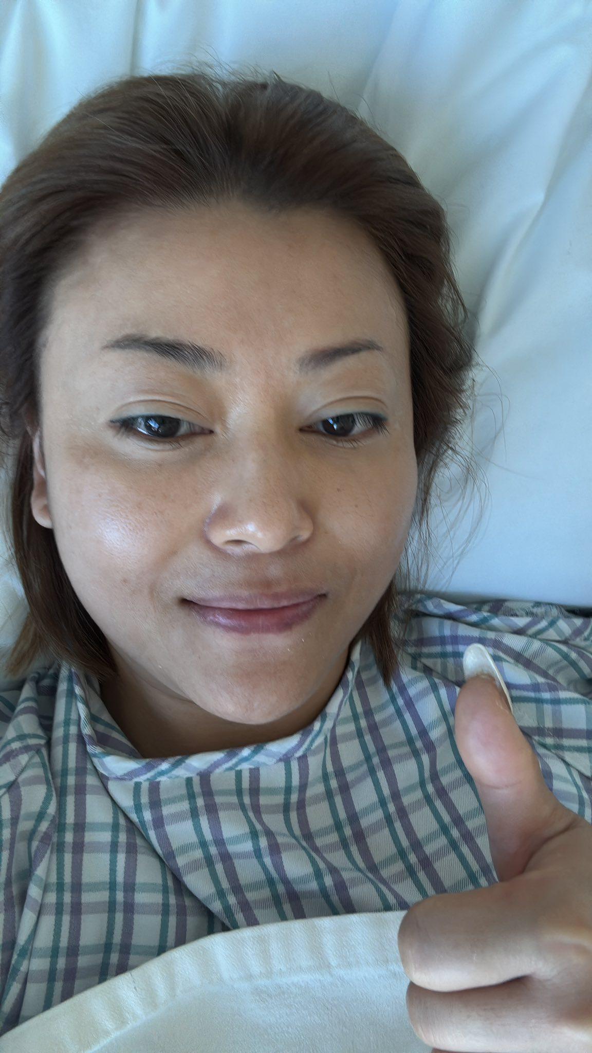 李佳入院割膽。