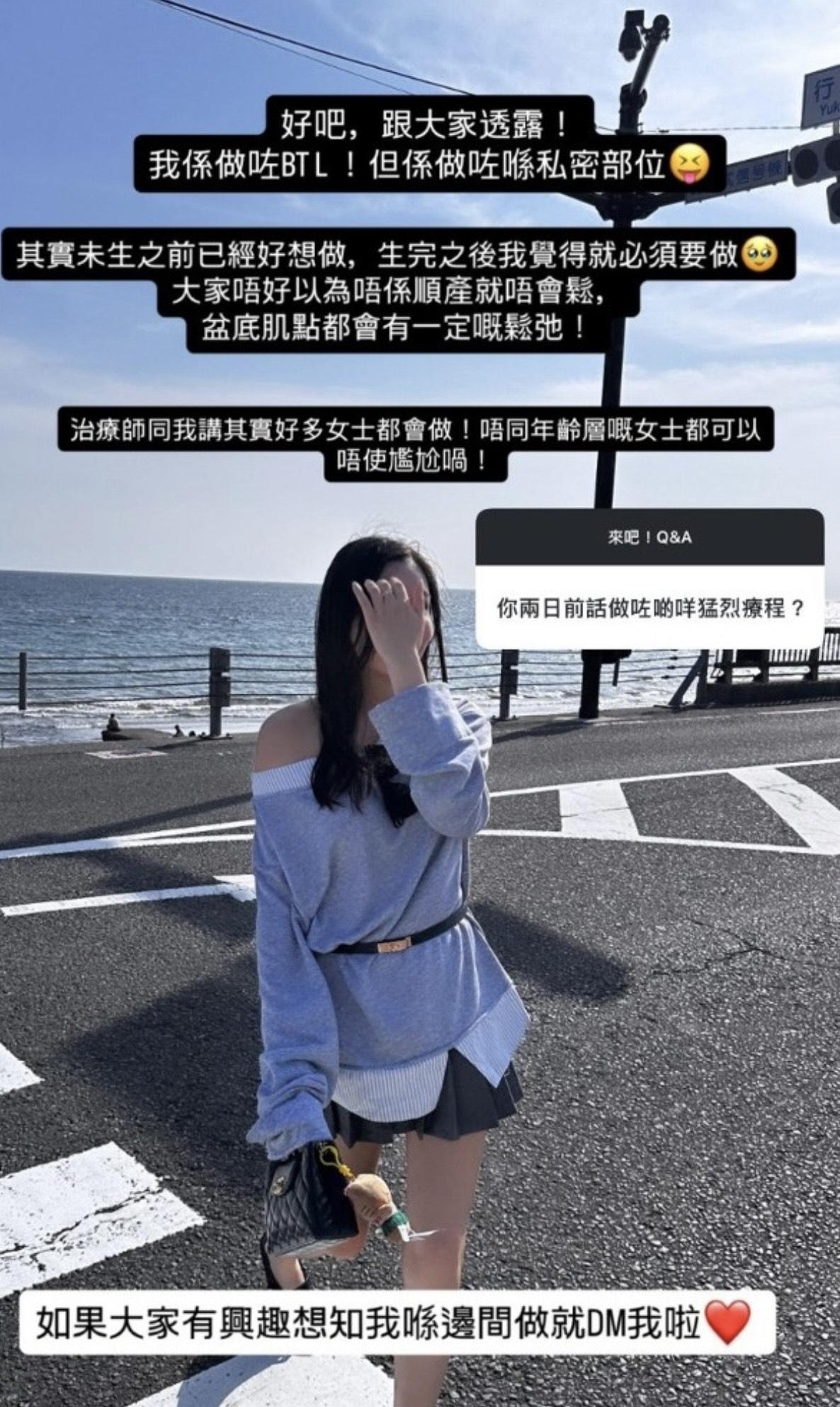 陳詩欣直認產前已經想做收陰手術。