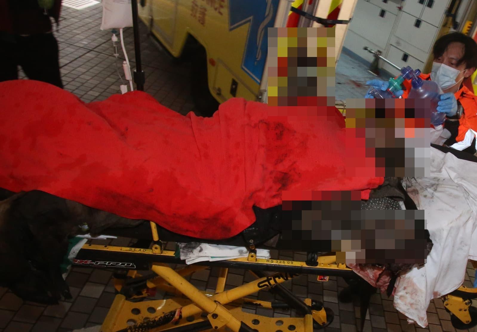 大埔宏福苑四級火|一名全身熏黑的消防員送到威爾斯親王醫院