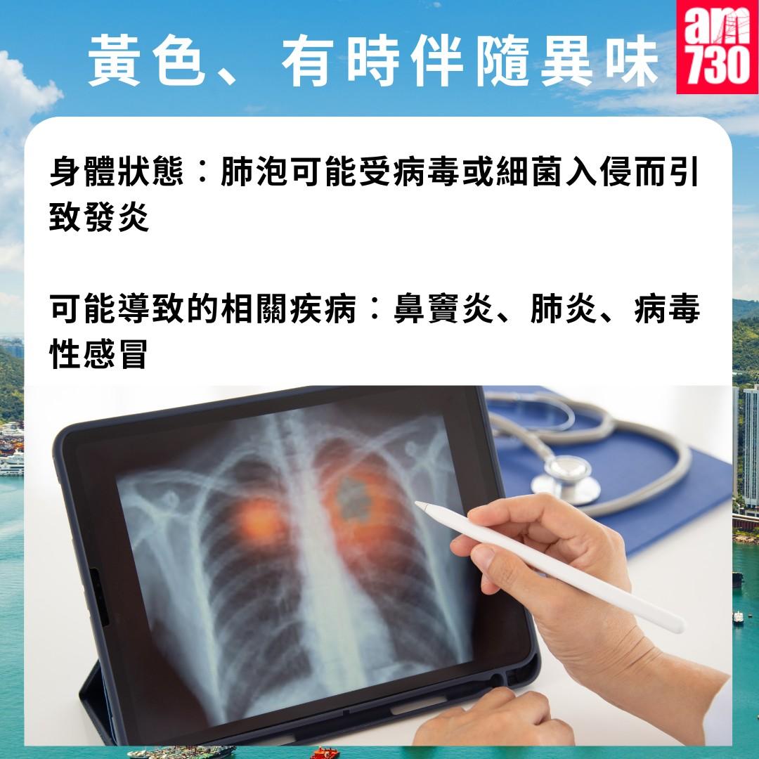 痰的顏色代表甚麼?黃色、有時伴隨異味(am730製圖)