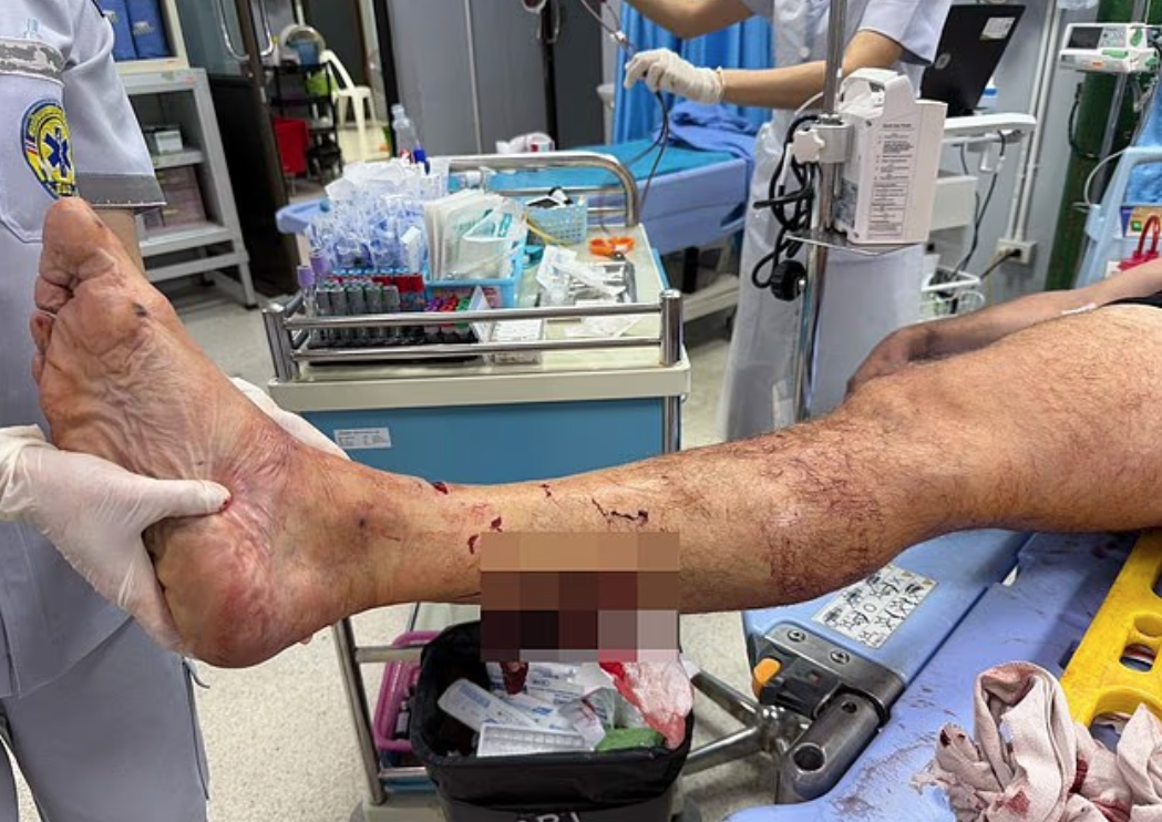 男子腿部等多處受傷,最終因失血過多不治。(互聯網)