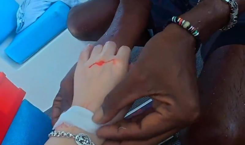 女子手腕明顯受創出血,僅作簡單包紮處理。(微博)