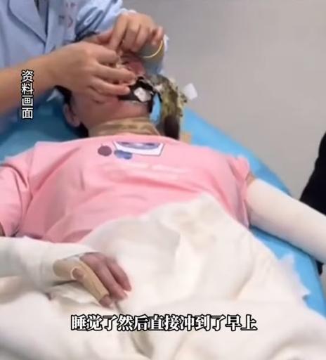 女子臉部及身體多處遭受嚴重的二至三度燒燙傷。(微博)
