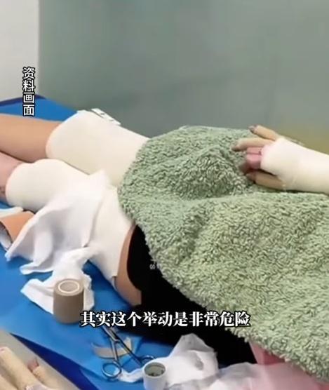 女子臉部及身體多處遭受嚴重的二至三度燒燙傷。(微博)