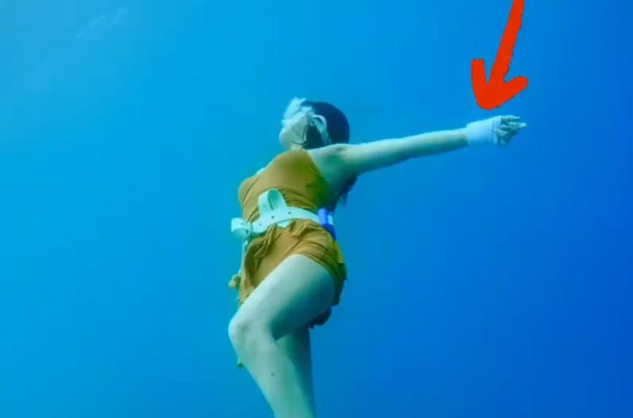 該名女子事後並未就醫,而是持續參與旅程活動。(微博)