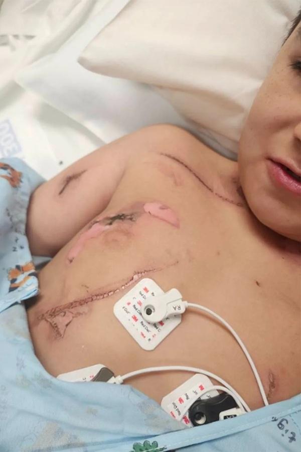 8歲童睡覺頸鏈卡手機充電器觸電 及時扯下頸鏈撿回一命