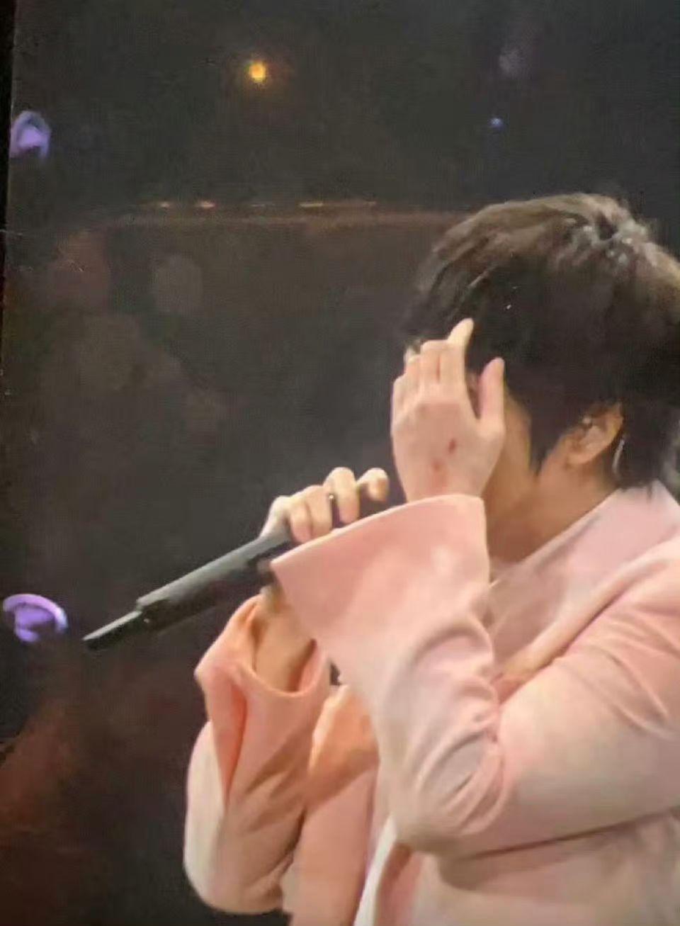 發生意外後,阿信在重新整理妝髮後負傷繼續表演。