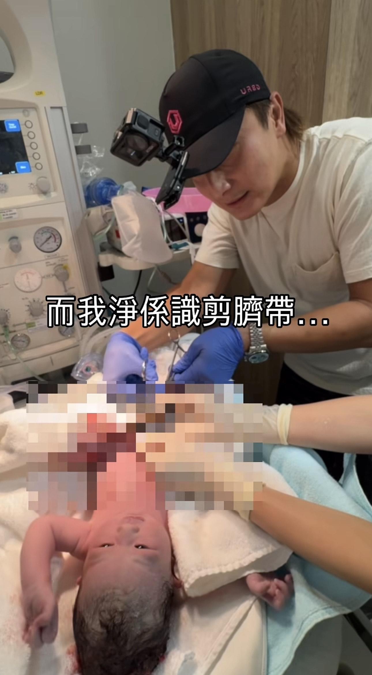 方力申亦有親手剪臍帶。