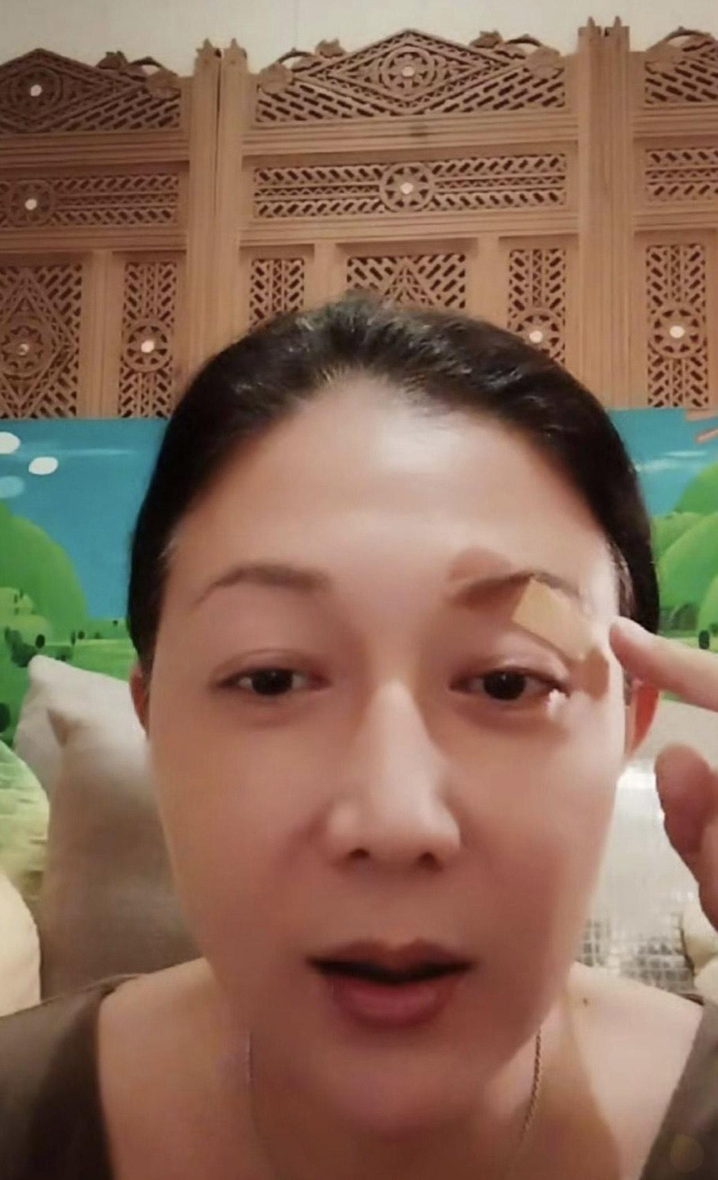 吳綺莉穿樹叢遭尖銳樹葉刮傷左眼眼角。