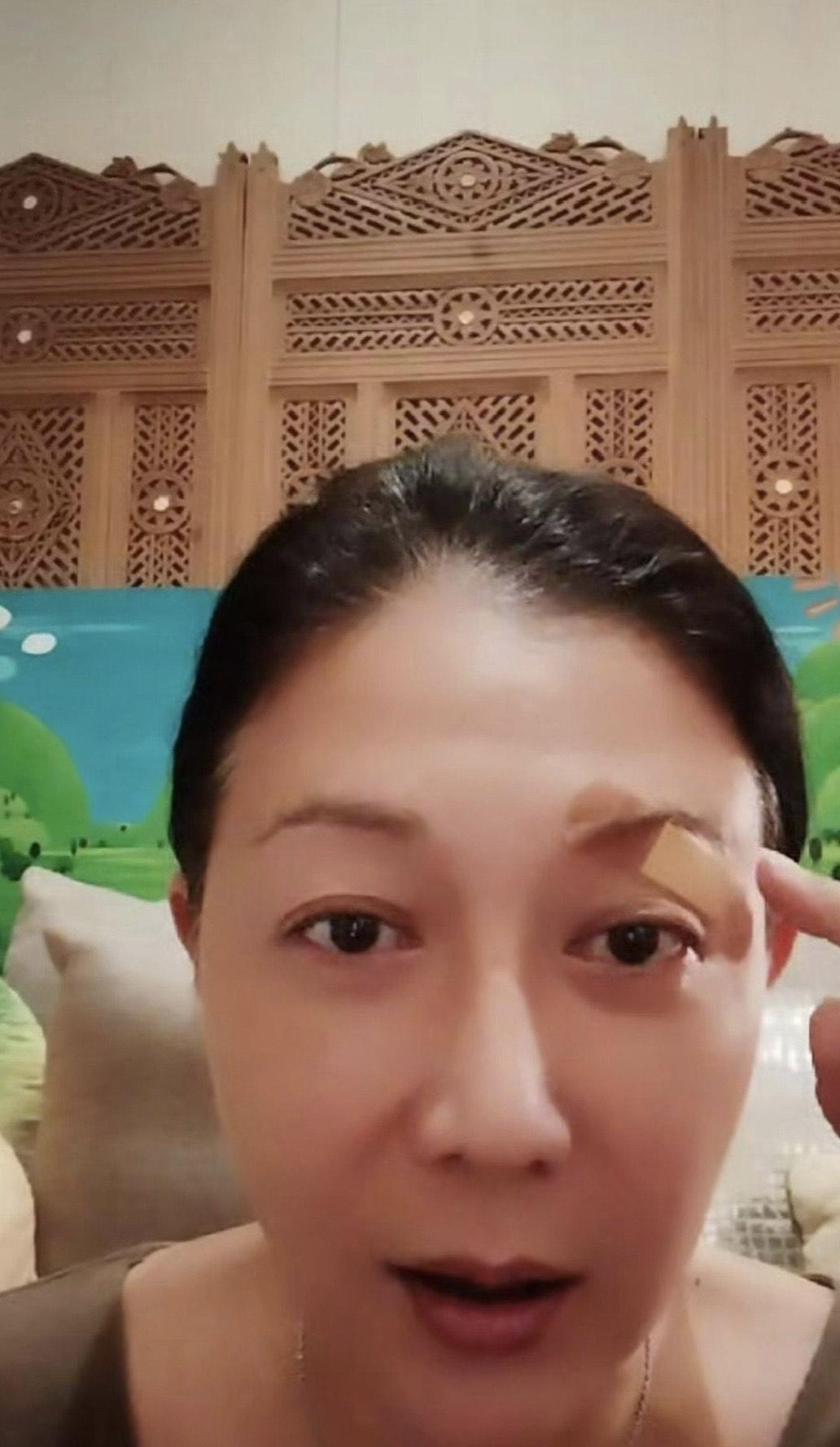 吳綺莉表示幸好未有傷到眼球,否則後果嚴重。