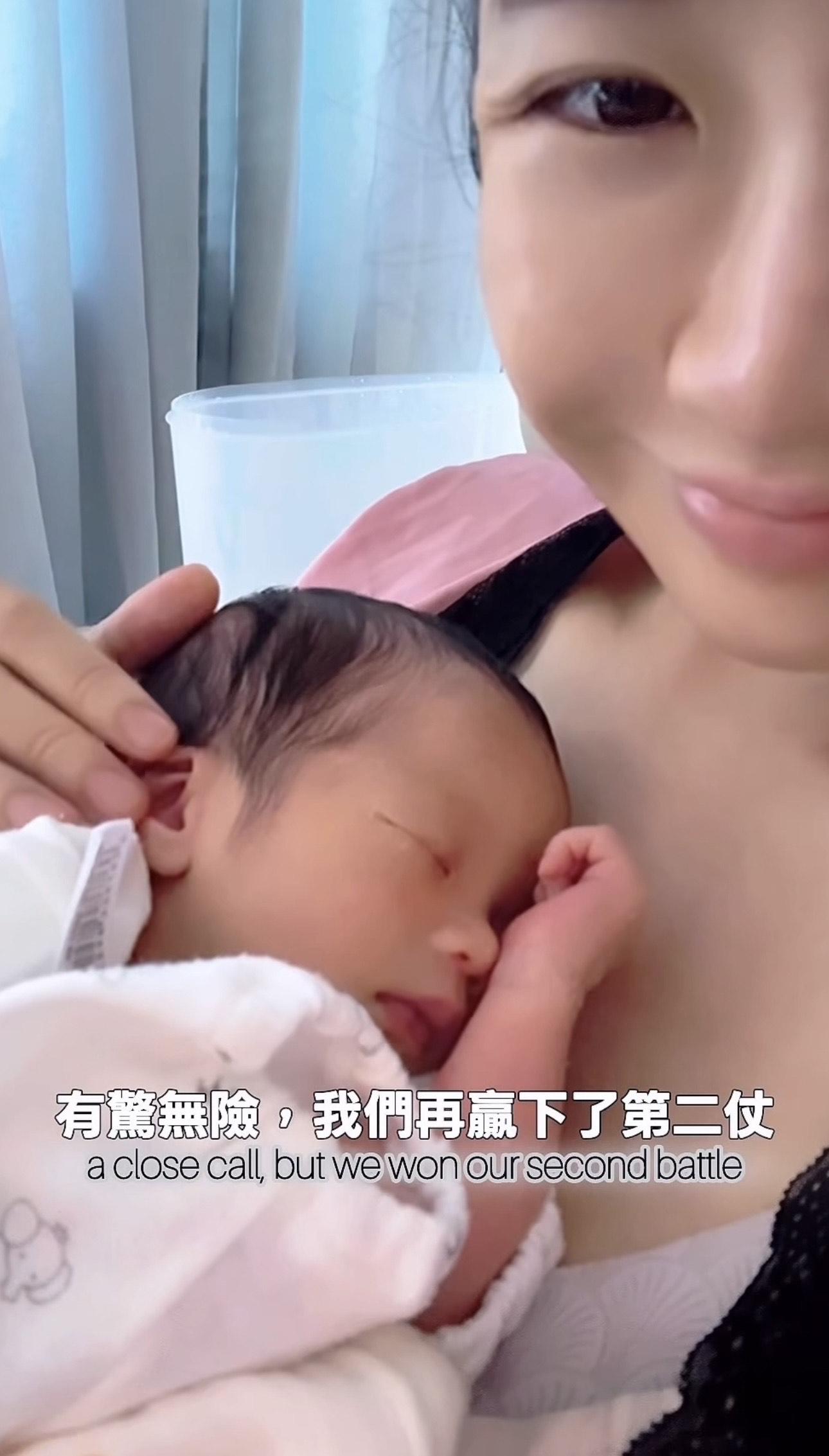 利穎怡爆懷孕期患7cm腺肌瘤 。