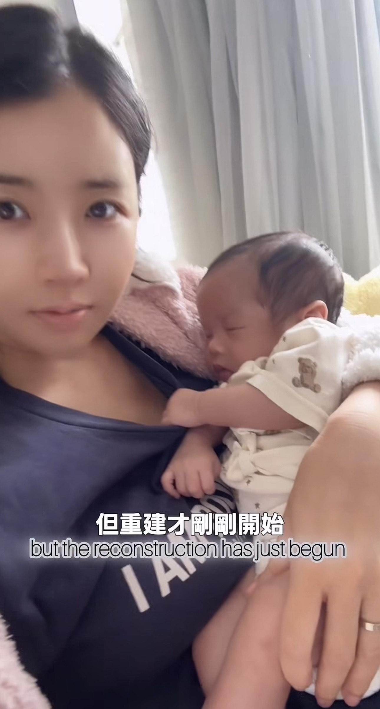 利穎怡指BB臍帶纏繞頸部兩周。