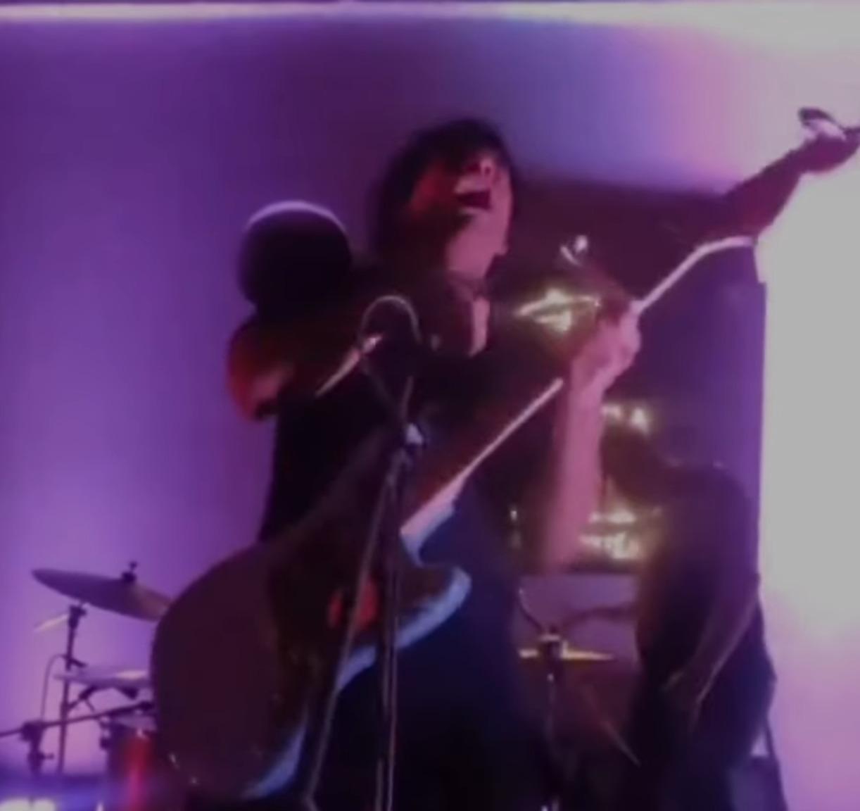 Mi Mejor Amigo Scott主音蘇亞雷斯(Carlos Suarez)頸部一級燒傷。