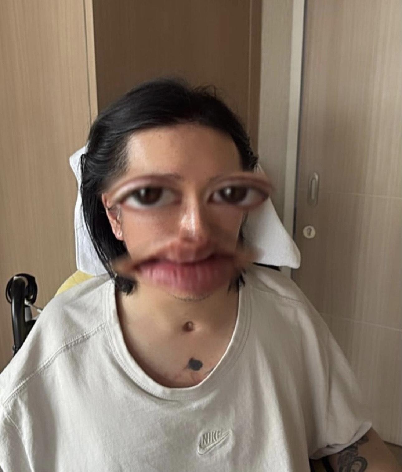 今日(1日)是2026年的第一天,正代表阿Mo會繼續接受治療。