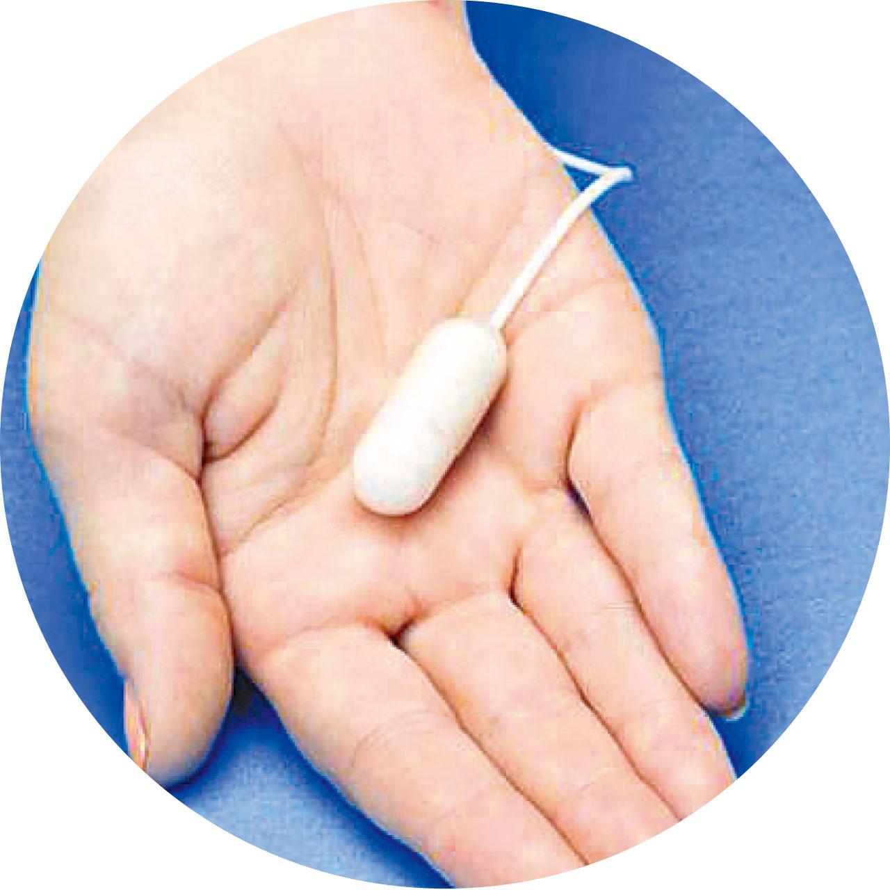 胃水球裝在子彈膠囊中。