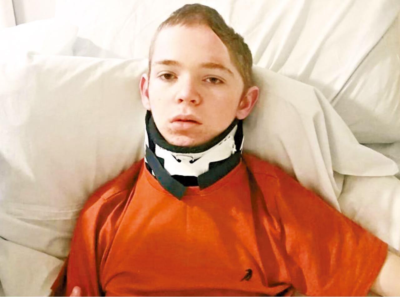 羅伯茨車禍後頭骨重創。(互聯網)