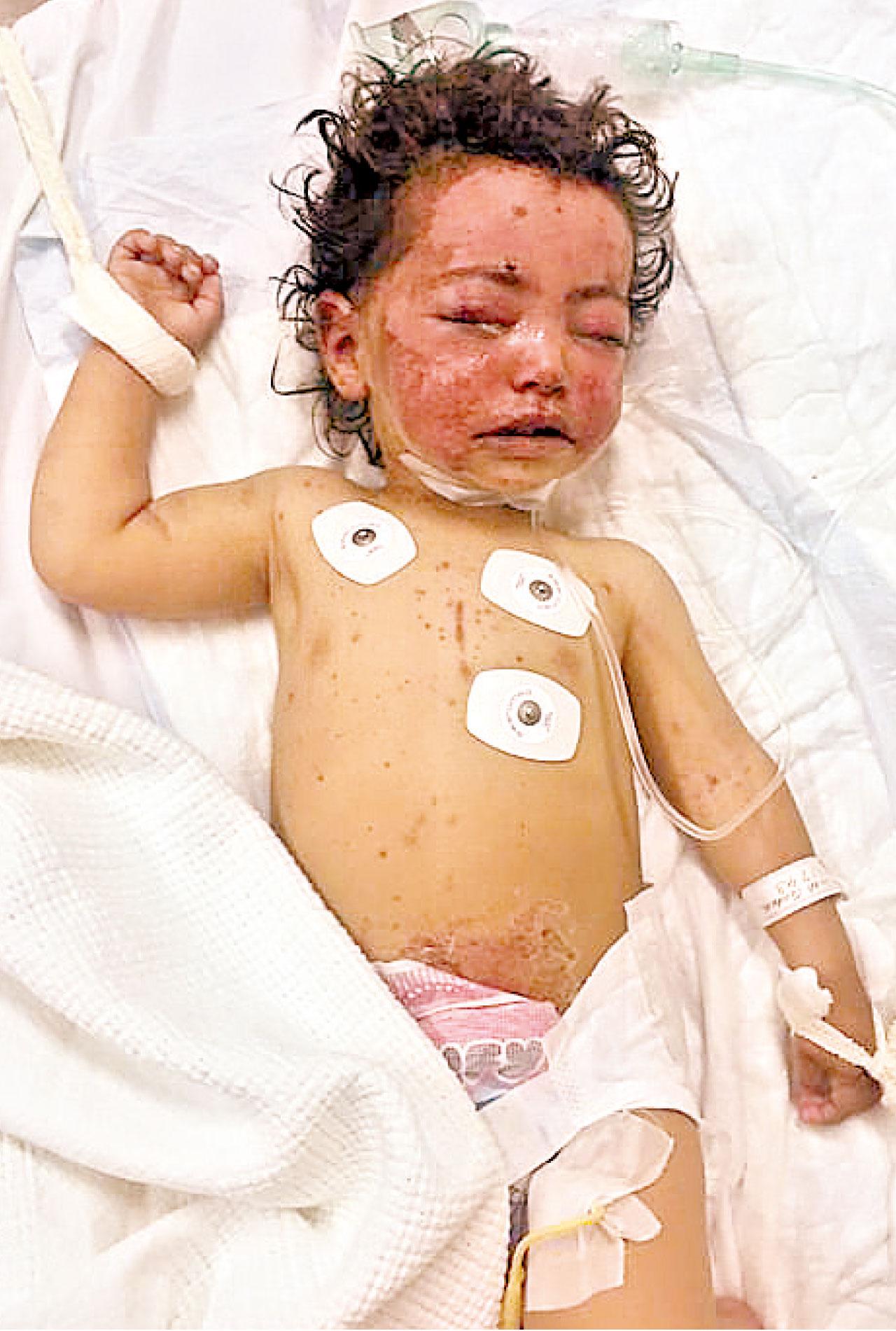 埃曼當日遍體鱗傷,醫生需綁住其手,以免她抓傷口。