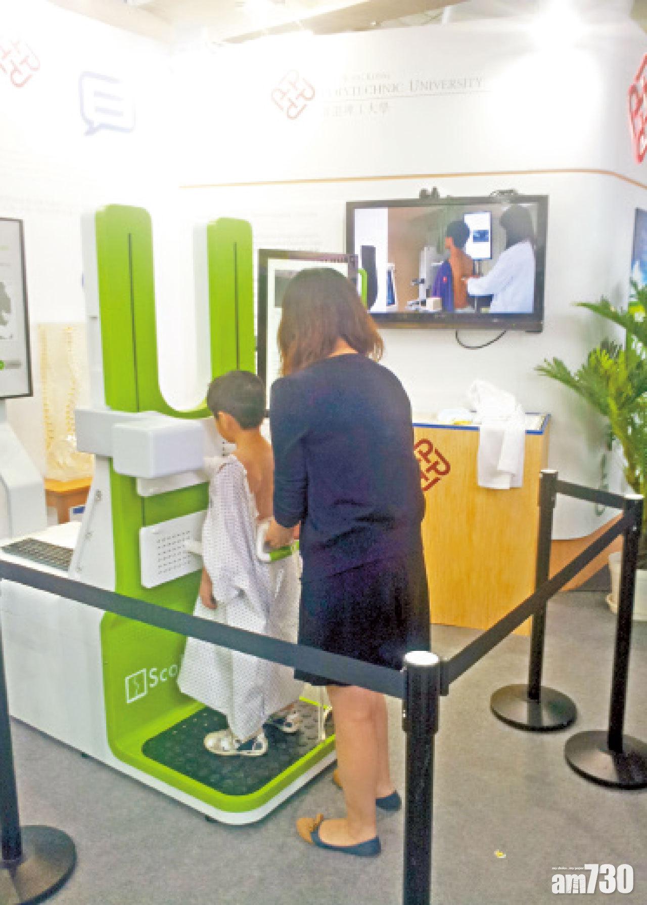 三維超聲脊柱側彎評估