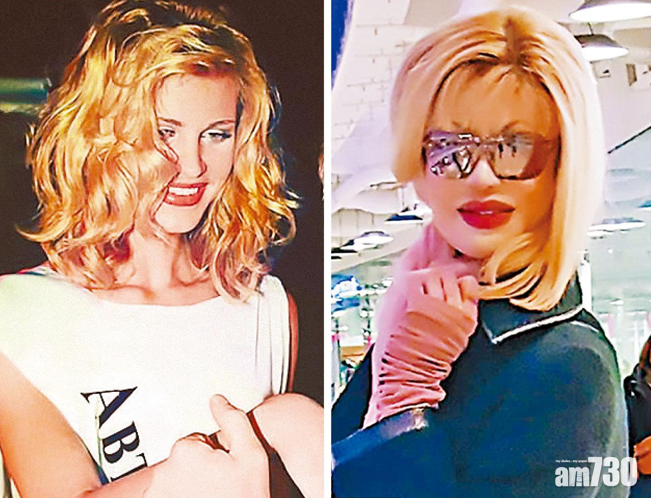 (左/右) 毀容前/ 整容後