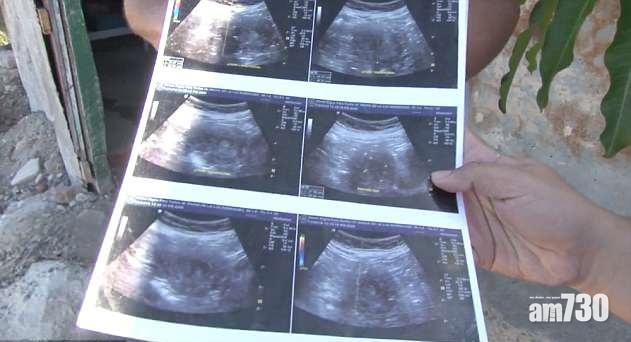 德拉盧斯向記者展示的超聲波照片。(互聯網)