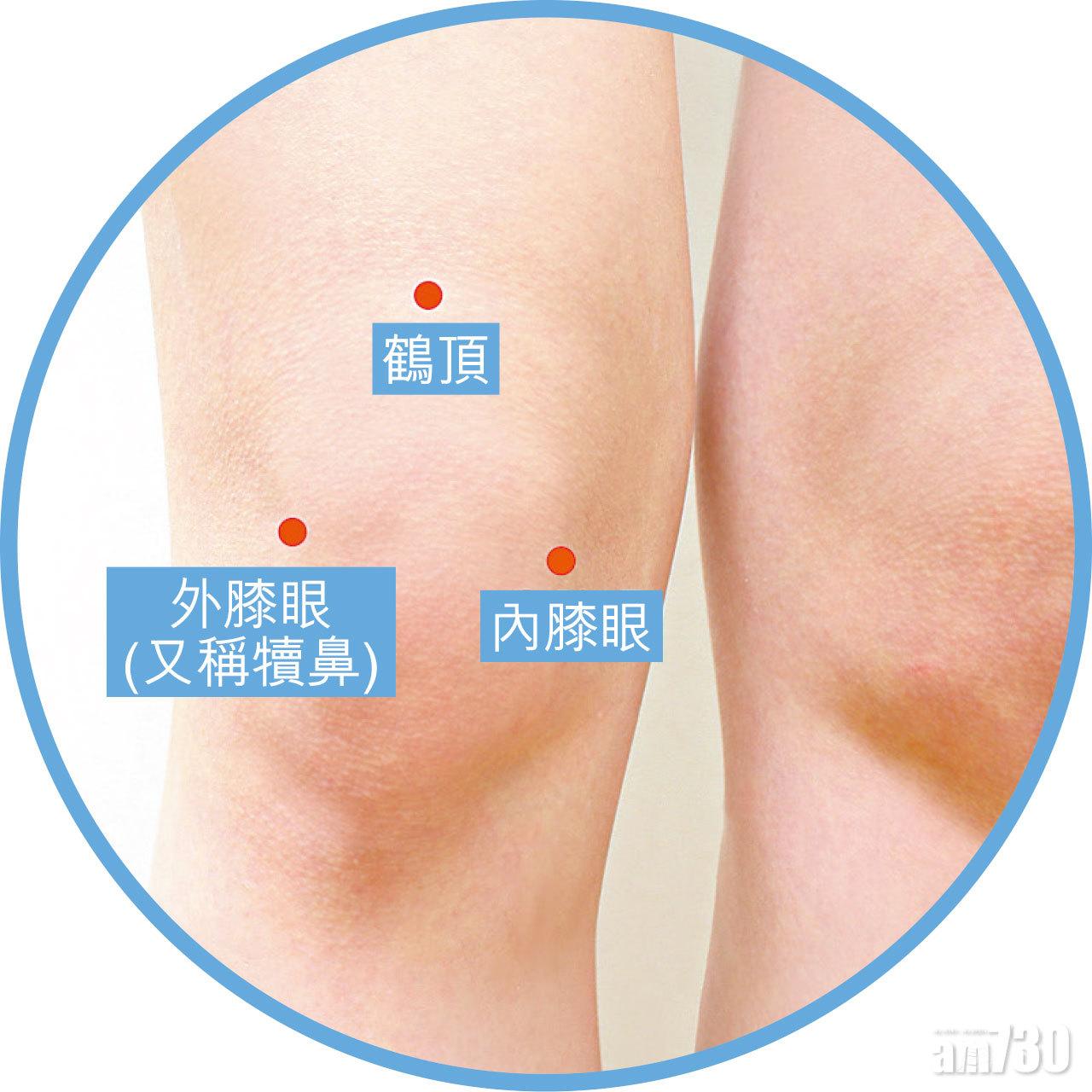 針炙三膝位 - 此為膝三針,為治療膝痛主要穴位。