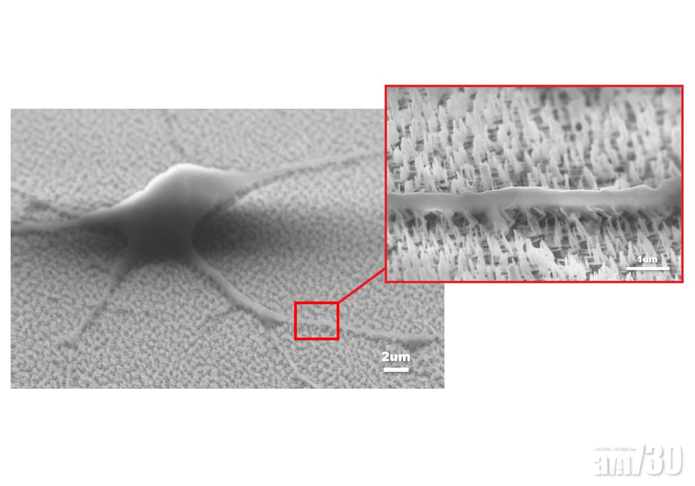 神經幹細胞在納米培養板上分化成為功能細胞。