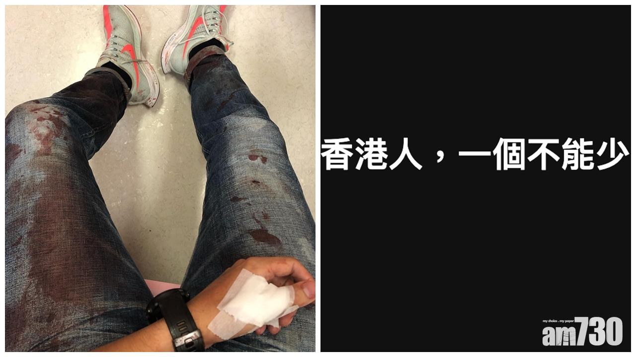 (柳俊江@FB)